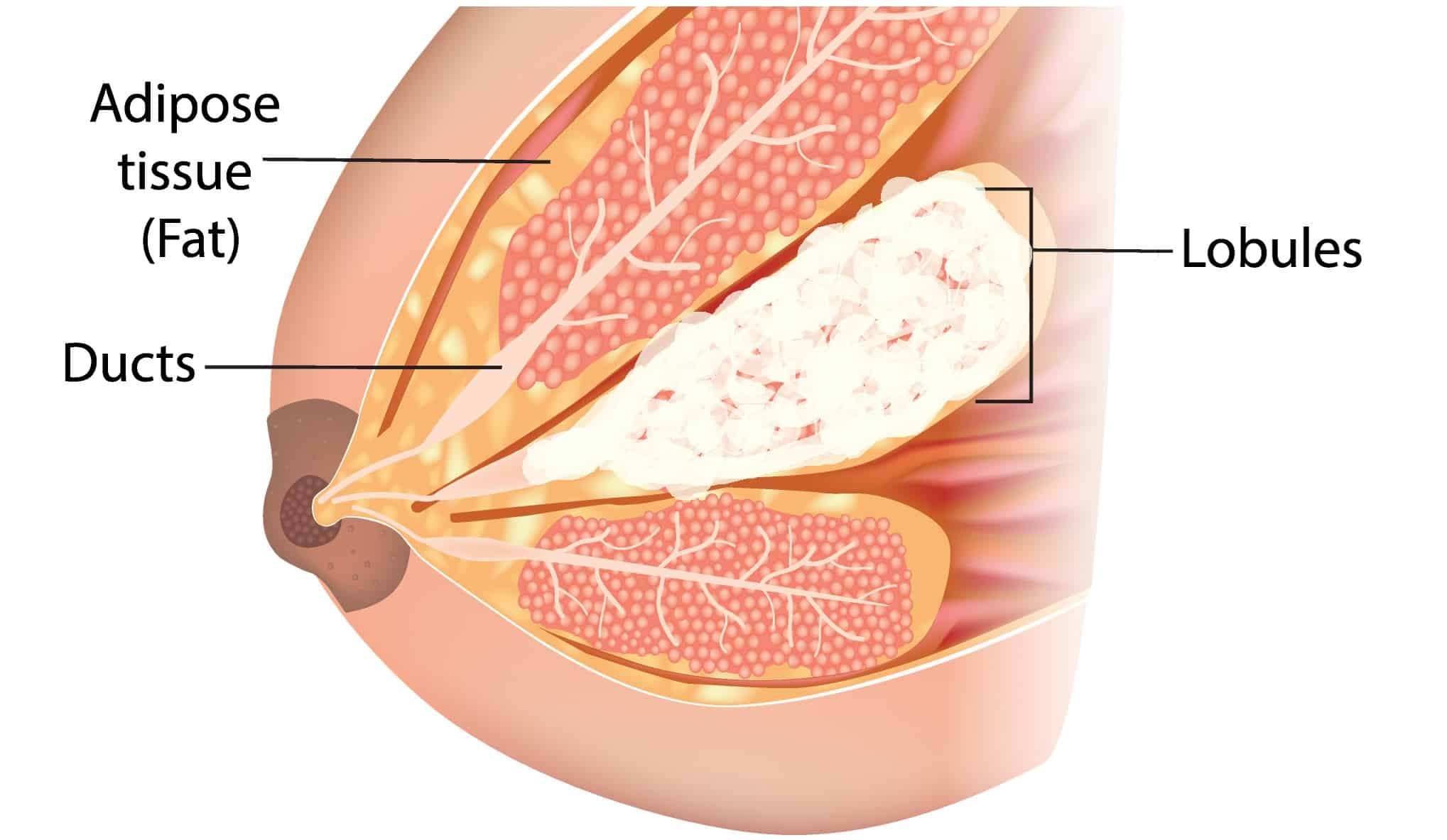 Blocked Milk Ducts